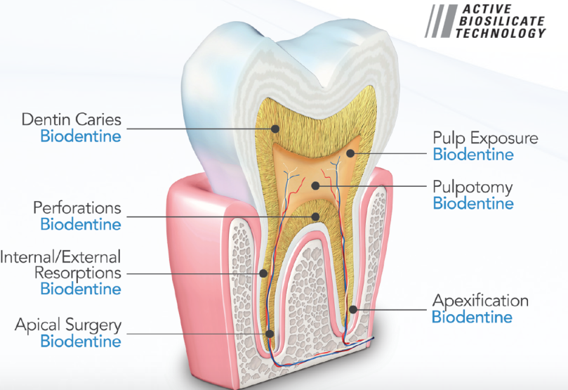 Septodont Biodentine Bioactive Dentin Substitute