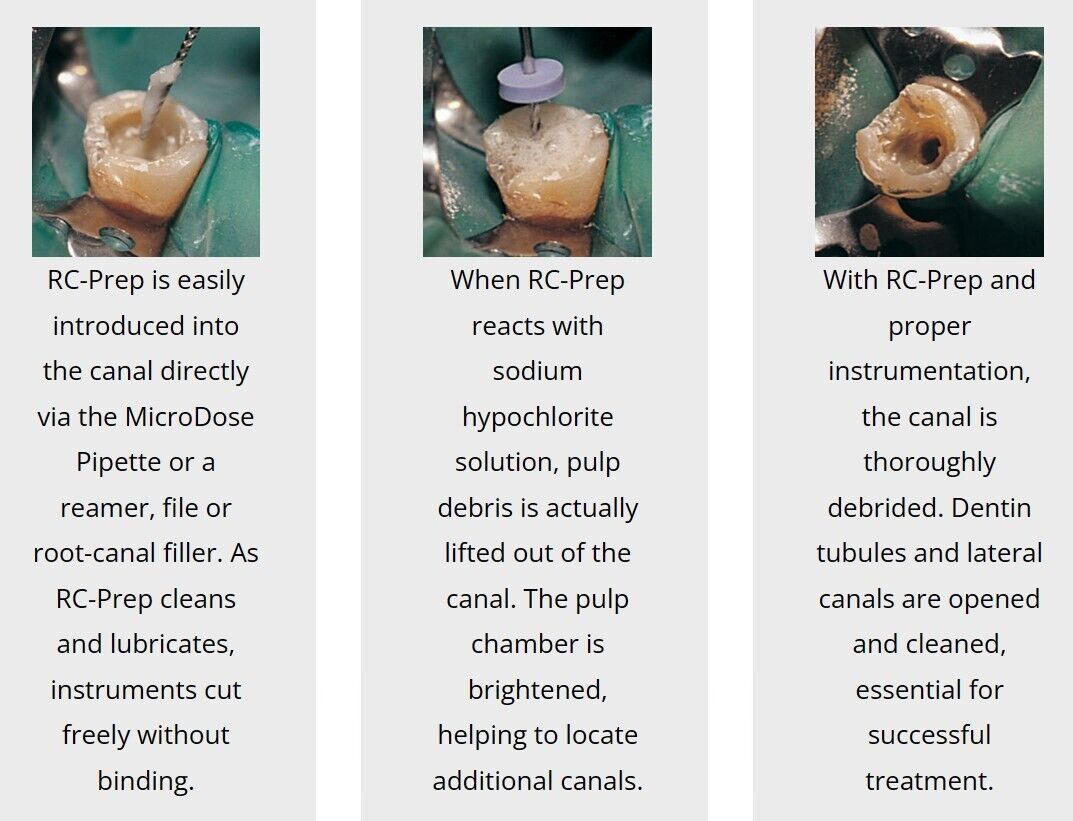 Premier RC-Prep Jar Root Canal Chemo-Mechanical Preparation Cream 2 x 18g