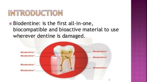 Septodont Biodentine Bioactive Dentin Substitute