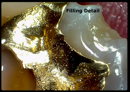 Sota Imaging - Claris i5HD Aluminum Intraoral Camera