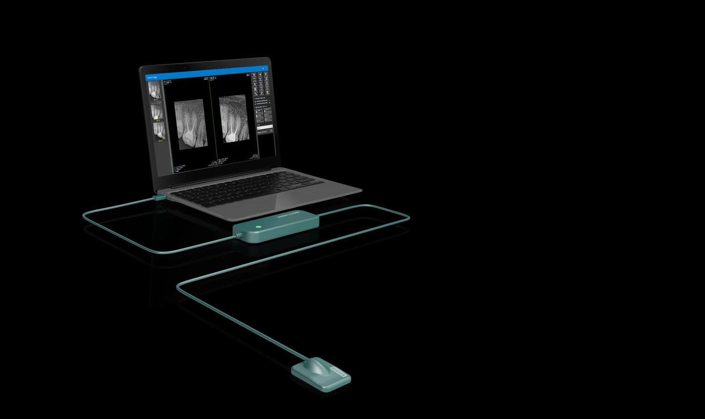 Xpect Vision Intraoral Sensor