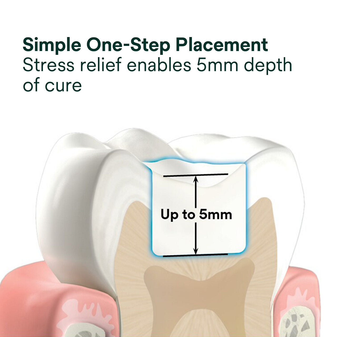 3M Filtek One Bulk Fill Restorative Capsules [20 x 0.2gm] different shades