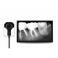 MADS ErgoRay X-Ray Sensors (Available in Sizes 1.0, 1.5 & 2.0)