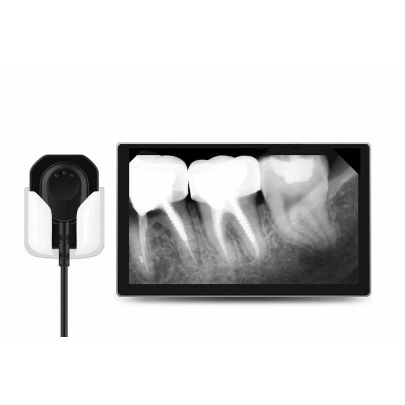 MADS ErgoRay X-Ray Sensors (Available in Sizes 1.0, 1.5 & 2.0)