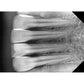 MADS ErgoRay X-Ray Sensors (Available in Sizes 1.0, 1.5 & 2.0)
