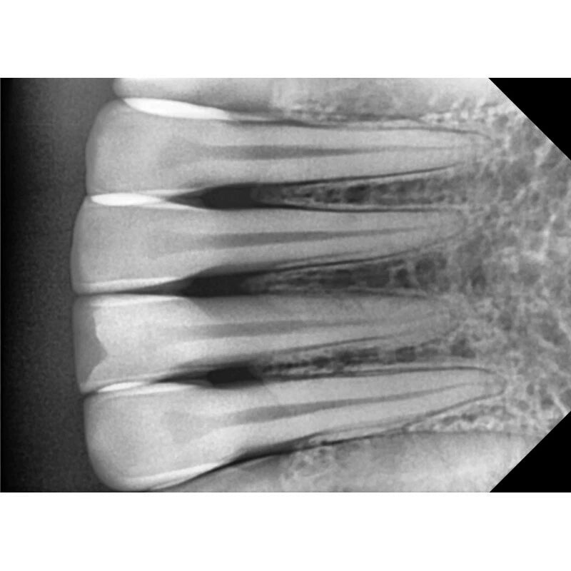 MADS ErgoRay X-Ray Sensors (Available in Sizes 1.0, 1.5 & 2.0)