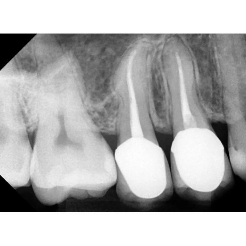 MADS ErgoRay X-Ray Sensors (Available in Sizes 1.0, 1.5 & 2.0)