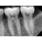 MADS ErgoRay X-Ray Sensors (Available in Sizes 1.0, 1.5 & 2.0)