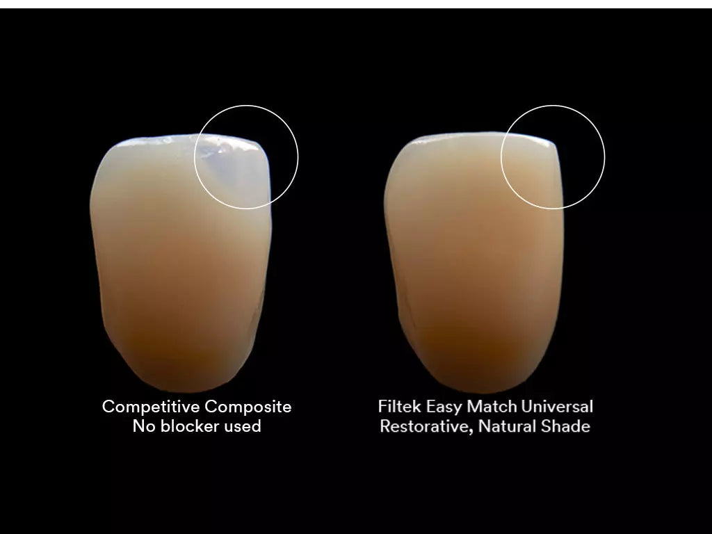 3M™ Filtek™ Easy Match Universal Restorative 4gm Syringe All Shades