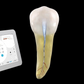 Dentsply Waveone Gold Glider ENDODONTIC RECIPROCATING Glide Path File 3pk