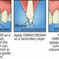 Tokuyama Omnichroma One Shade Resin-Based Restorative Blocker 4gm Syringe